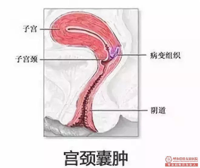 禄劝做无痛人流手术多少钱